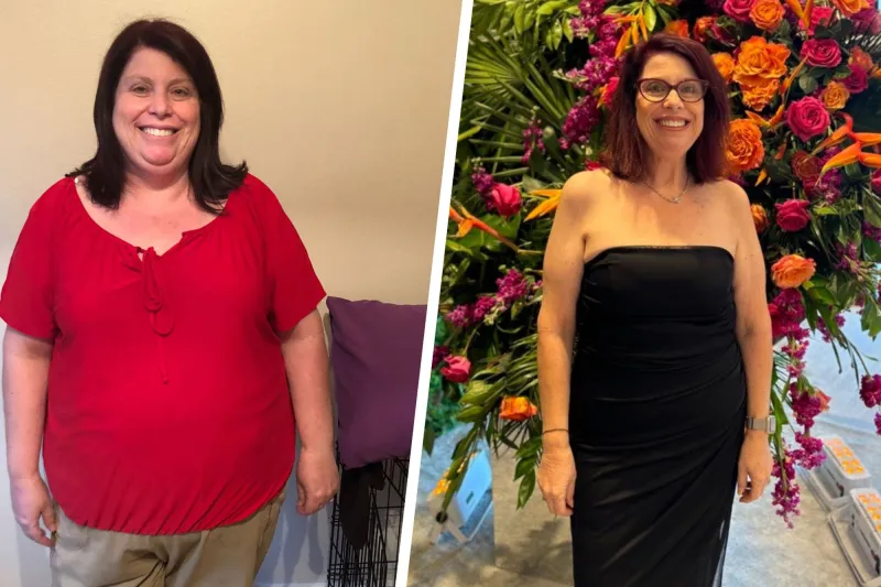 Bariatric Patient melissa-torr